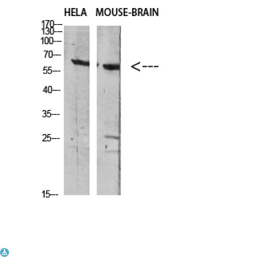 SLC6A1 / GAT-1 Antibody - Western blot analysis of Hela and mouse brain cell lysate. Secondary antibody was diluted at 1:20000.