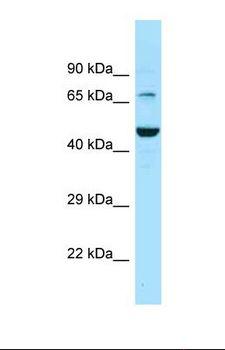 SLC6A11 / GAT-3 Antibody - Western blot of Human PANC1 . SLC6A11 antibody dilution 1.0 ug/ml.  This image was taken for the unconjugated form of this product. Other forms have not been tested.