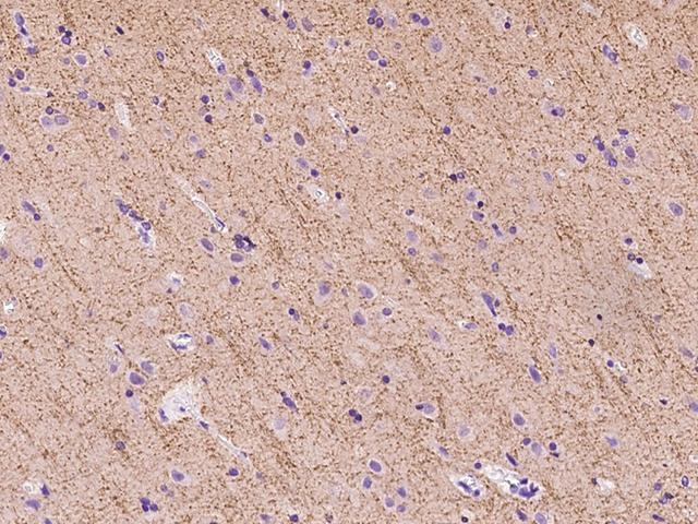 SLC6A11 / GAT-3 Antibody - Immunochemical staining of human SLC6A11 in human brain with rabbit polyclonal antibody at 1:100 dilution, formalin-fixed paraffin embedded sections.