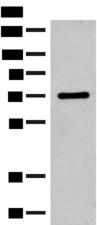 SLC6A11 / GAT-3 Antibody - Western blot analysis of Rat brain tissue lysate  using SLC6A11 Polyclonal Antibody at dilution of 1:500
