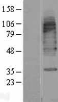 SLC6A11 / GAT-3 Protein - Western validation with an anti-DDK antibody * L: Control HEK293 lysate R: Over-expression lysate