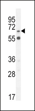 SLC6A12 / BGT-1 Antibody - S6A12 Antibody western blot of MDA-MB231 cell line lysates (35 ug/lane). The S6A12 antibody detected the S6A12 protein (arrow).