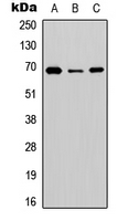 SLC6A12 / BGT-1 Antibody - Western blot analysis of BGT-1 expression in HEK293T (A); NS-1 (B); PC12 (C) whole cell lysates.
