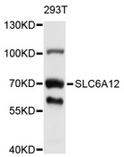 SLC6A12 / BGT-1 Antibody - Western blot analysis of extracts of 293T cells, using SLC6A12 antibody at 1:1000 dilution. The secondary antibody used was an HRP Goat Anti-Rabbit IgG (H+L) at 1:10000 dilution. Lysates were loaded 25ug per lane and 3% nonfat dry milk in TBST was used for blocking. An ECL Kit was used for detection and the exposure time was 5s.