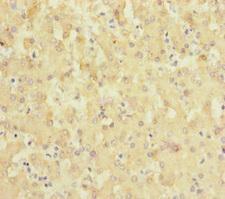 SLC6A12 / BGT-1 Antibody - Immunohistochemistry of paraffin-embedded human liver tissue at dilution of 1:100