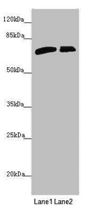 SLC6A12 / BGT-1 Antibody - Western blot All Lanes: SLC6A12 antibody at 4.47 ug/ml Lane 1: 293T whole cell lysate Lane 2: PC-3 whole cell lysate Secondary Goat polyclonal to rabbit IgG at 1/10000 dilution Predicted band size: 69 kDa Observed band size: 69 kDa