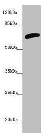 SLC6A12 / BGT-1 Antibody - Western blot All lanes: SLC6A12 antibody at 4.47µg/ml + PC-3 whole cell lysate Secondary Goat polyclonal to rabbit IgG at 1/10000 dilution Predicted band size: 70 kDa Observed band size: 70 kDa