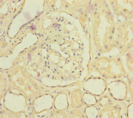 SLC6A12 / BGT-1 Antibody - Immunohistochemistry of paraffin-embedded human kidney tissue at dilution of 1:100