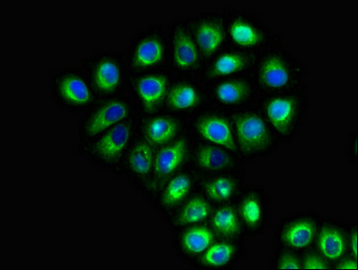 SLC6A13 / GAT-2 Antibody - Immunofluorescent analysis of A549 cells diluted at 1:100 and Alexa Fluor 488-congugated AffiniPure Goat Anti-Rabbit IgG(H+L)