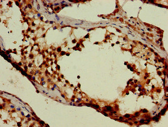 SLC6A13 / GAT-2 Antibody - Immunohistochemistry of paraffin-embedded human testis tissue at dilution of 1:100