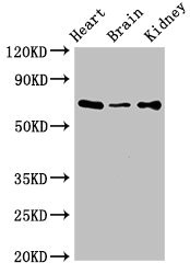 SLC6A13 / GAT-2 Antibody - Western Blot Positive WB detected in:Mouse heart tissue,Mouse brain tissue,Mouse kidney tissue All Lanes:SLC6A13 antibody at 3µg/ml Secondary Goat polyclonal to rabbit IgG at 1/50000 dilution Predicted band size: 69,58,11 KDa Observed band size: 69 KDa