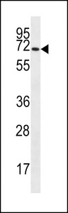 SLC6A14 Antibody - SLC6A14 Antibody western blot of HL-60 cell line lysates (35 ug/lane). The SLC6A14 antibody detected the SLC6A14 protein (arrow).