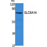 SLC6A14 Antibody - Western blot of SLC6A14 antibody