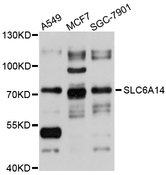 SLC6A14 Antibody - Western blot analysis of extracts of various cell lines, using SLC6A14 antibody at 1:1000 dilution. The secondary antibody used was an HRP Goat Anti-Rabbit IgG (H+L) at 1:10000 dilution. Lysates were loaded 25ug per lane and 3% nonfat dry milk in TBST was used for blocking. An ECL Kit was used for detection and the exposure time was 15s.