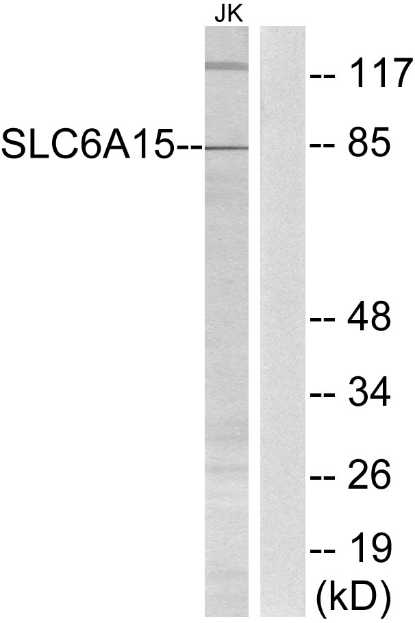 SLC6A15 / SBAT1 Antibody - Western blot analysis of lysates from Jurkat cells, using SLC6A15 Antibody. The lane on the right is blocked with the synthesized peptide.
