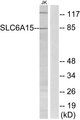 SLC6A15 / SBAT1 Antibody - Western blot analysis of lysates from Jurkat cells, using SLC6A15 Antibody. The lane on the right is blocked with the synthesized peptide.