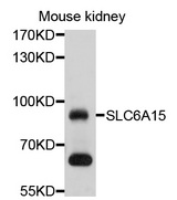 SLC6A15 / SBAT1 Antibody - Western blot analysis of extracts of mouse kidney, using SLC6A15 antibody at 1:1000 dilution. The secondary antibody used was an HRP Goat Anti-Rabbit IgG (H+L) at 1:10000 dilution. Lysates were loaded 25ug per lane and 3% nonfat dry milk in TBST was used for blocking. An ECL Kit was used for detection and the exposure time was 30s.