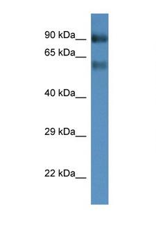 SLC6A15 / SBAT1 Antibody - SLC6A15 antibody Western blot of Mouse Kidney lysate. Antibody concentration 1 ug/ml. This image was taken for the unconjugated form of this product. Other forms have not been tested.