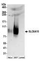 SLC6A15 / SBAT1 Antibody - Detection of human SLC6A15 by western blot. Samples: Whole cell lysate (50 µg) from HeLa, HEK293T, and Jurkat cells prepared using NETN lysis buffer. Antibodies: Affinity purified rabbit anti-SLC6A15 antibody used for WB at 0.1 µg/ml. Detection: Chemiluminescence with an exposure time of 3 minutes.