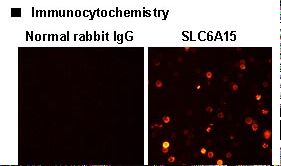 SLC6A15 / SBAT1 Antibody