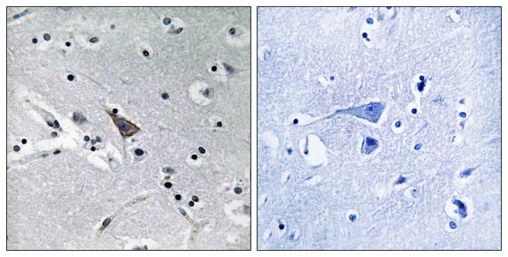 SLC6A16 Antibody - Immunohistochemistry analysis of paraffin-embedded human brain, using SLC6A16 Antibody. The picture on the right is blocked with the synthesized peptide.