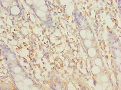 SLC6A16 Antibody - Immunohistochemistry of paraffin-embedded human rectum tissue using antibody at dilution of 1:100.