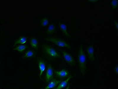 SLC6A16 Antibody - Immunofluorescent analysis of A549 cells using SLC6A16 Antibody at dilution of 1:100 and Alexa Fluor 488-congugated AffiniPure Goat Anti-Rabbit IgG(H+L)
