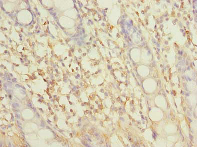 SLC6A16 Antibody - Immunohistochemistry of paraffin-embedded human colon tissue using SLC6A16 Antibody at dilution of 1:100