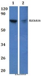 SLC6A16 Antibody - Western blot of SLC6A16 antibody at 1:500 dilution. Lane 1: HEK293T whole cell lysate.