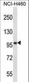 SLC6A17 Antibody - SLC6A17 Antibody western blot of NCI-H460 cell line lysates (35 ug/lane). The SLC6A17 antibody detected the SLC6A17 protein (arrow).