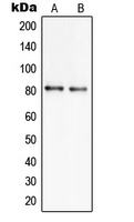 SLC6A17 Antibody - Western blot analysis of SLC6A17 expression in NCIH460 (A); U251MG (B) whole cell lysates.