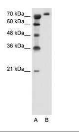 SLC6A18 / XTRP2 Antibody - A: Marker, B: Jurkat Cell Lysate.  This image was taken for the unconjugated form of this product. Other forms have not been tested.
