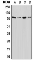 SLC6A18 / XTRP2 Antibody - Western blot analysis of XTRP2 expression in Jurkat (A); THP1 (B); Raw264.7 (C); PC12 (D) whole cell lysates.