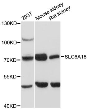 SLC6A18 / XTRP2 Antibody - Western blot analysis of extracts of various cell lines, using SLC6A18 antibody at 1:3000 dilution. The secondary antibody used was an HRP Goat Anti-Rabbit IgG (H+L) at 1:10000 dilution. Lysates were loaded 25ug per lane and 3% nonfat dry milk in TBST was used for blocking. An ECL Kit was used for detection and the exposure time was 30s.