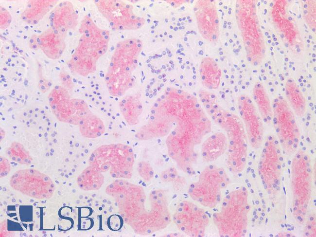 SLC6A19 Antibody - Human Kidney: Formalin-Fixed, Paraffin-Embedded (FFPE)