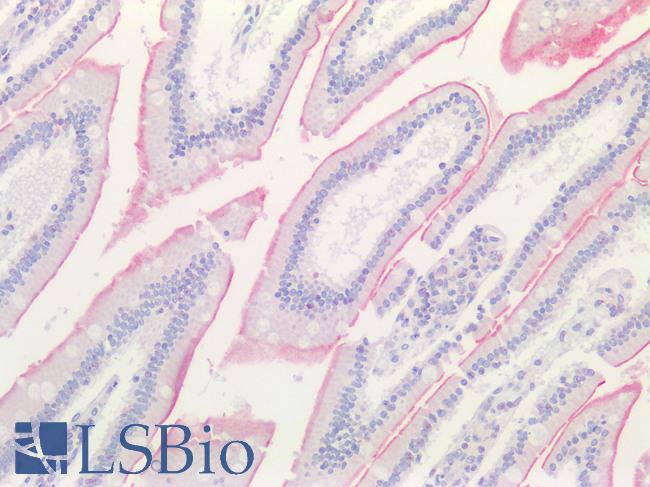 SLC6A19 Antibody - Human Small Intestine: Formalin-Fixed, Paraffin-Embedded (FFPE)