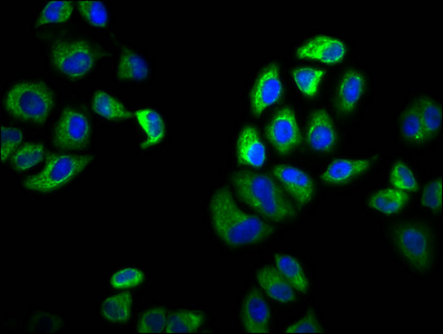 SLC6A19 Antibody - Immunofluorescence staining of Hela cells diluted at 1:100, counter-stained with DAPI. The cells were fixed in 4% formaldehyde, permeabilized using 0.2% Triton X-100 and blocked in 10% normal Goat Serum. The cells were then incubated with the antibody overnight at 4°C.The Secondary antibody was Alexa Fluor 488-congugated AffiniPure Goat Anti-Rabbit IgG (H+L).