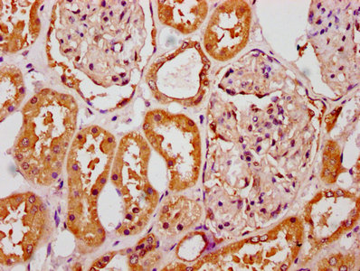 SLC6A19 Antibody - Immunohistochemistry Dilution at 1:300 and staining in paraffin-embedded human kidney tissue performed on a Leica BondTM system. After dewaxing and hydration, antigen retrieval was mediated by high pressure in a citrate buffer (pH 6.0). Section was blocked with 10% normal Goat serum 30min at RT. Then primary antibody (1% BSA) was incubated at 4°C overnight. The primary is detected by a biotinylated Secondary antibody and visualized using an HRP conjugated SP system.