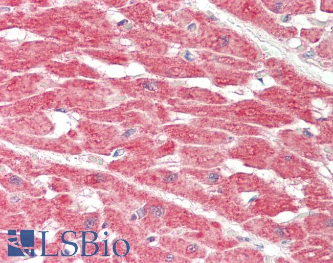 SLC6A2 / NET Antibody - Human Heart: Formalin-Fixed, Paraffin-Embedded (FFPE).  This image was taken for the unconjugated form of this product. Other forms have not been tested.