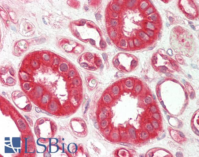 SLC6A2 / NET Antibody - Human Kidney: Formalin-Fixed, Paraffin-Embedded (FFPE).  This image was taken for the unconjugated form of this product. Other forms have not been tested.