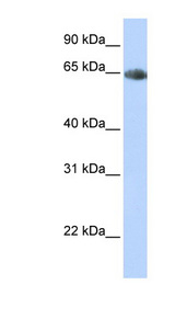 SLC6A2 / NET Antibody - SLC6A2 antibody Western blot of Fetal Heart lysate. This image was taken for the unconjugated form of this product. Other forms have not been tested.