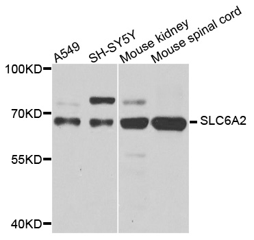 SLC6A2 / NET Antibody - Western blot analysis of extracts of various cell lines, using SLC6A2 antibody at 1:1000 dilution. The secondary antibody used was an HRP Goat Anti-Rabbit IgG (H+L) at 1:10000 dilution. Lysates were loaded 25ug per lane and 3% nonfat dry milk in TBST was used for blocking. An ECL Kit was used for detection and the exposure time was 10s.
