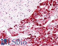 SLC6A2 / NET Antibody - Human Adrenal: Formalin-Fixed, Paraffin-Embedded (FFPE)