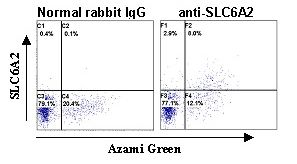 SLC6A2 / NET Antibody