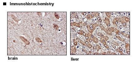 SLC6A2 / NET Antibody