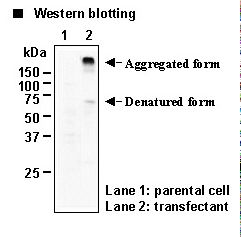 SLC6A2 / NET Antibody