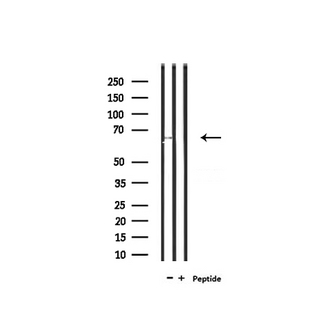 SLC6A20 Antibody - Western blot analysis of extracts of rat liver tissue using SLC6A20 antibody.