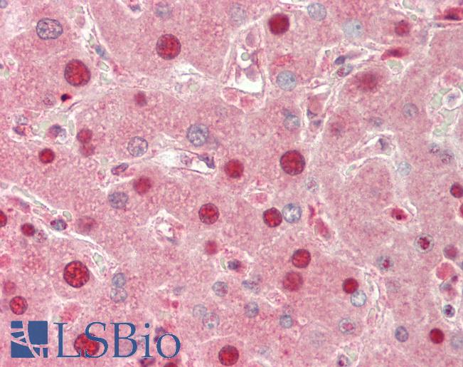 SLC6A3 / Dopamine Transporter Antibody - Human Liver: Formalin-Fixed, Paraffin-Embedded (FFPE).  This image was taken for the unconjugated form of this product. Other forms have not been tested.