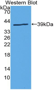 SLC6A3 / Dopamine Transporter Antibody - Western blot of recombinant SLC6A3 / Dopamine Transporter.