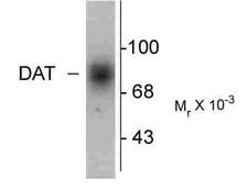 SLC6A3 / Dopamine Transporter Antibody - Western blot of human caudate lysate showing specific immunolabeling of the ~88k DAT protein.